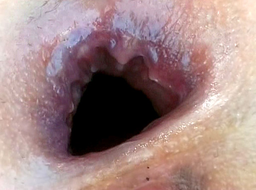 sodomies